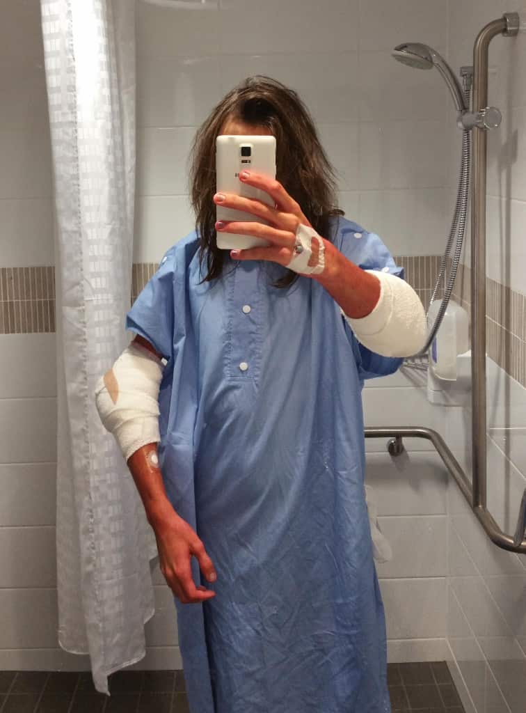 Jordan in hospital with bandaged elbows.