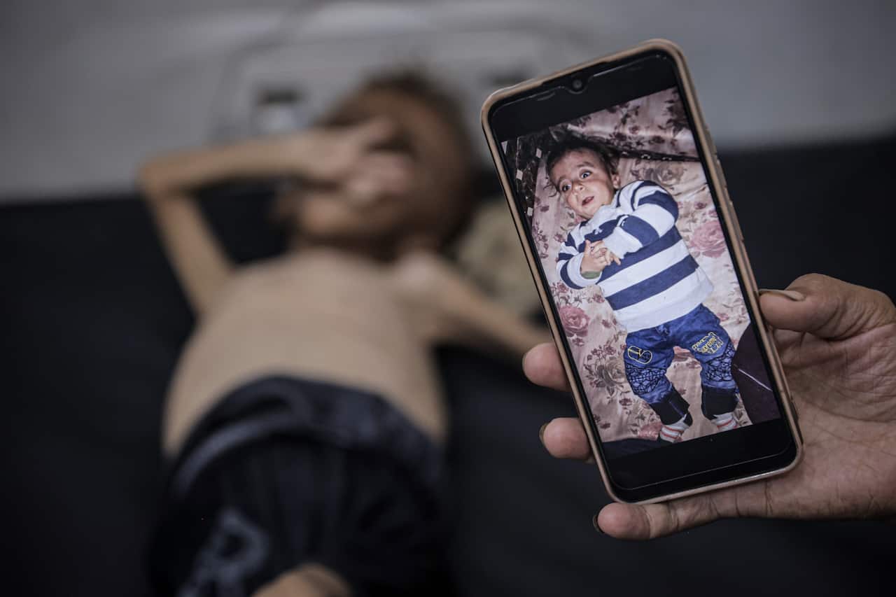 A picture of a baby on a phone in front of a frail child