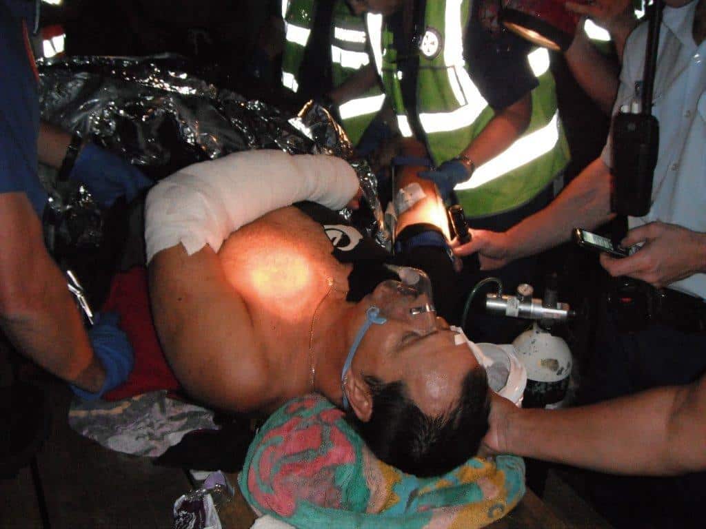 A man with a bandaged arm is given oxygen by several paramedic staff.