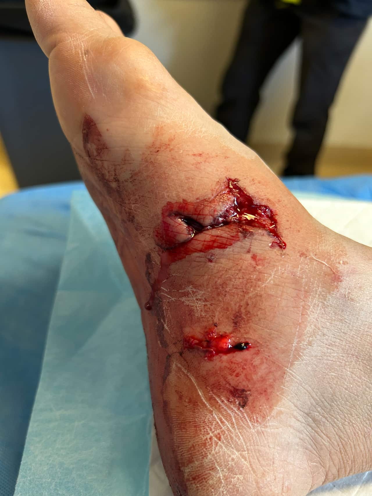 Explicit_Kalgoorlie_attack_1.jpg