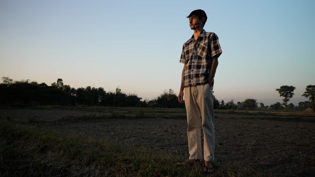A young man stands in a field, looking out to the distance. He has one hand in his pocket. There is a scar on his left jaw. 