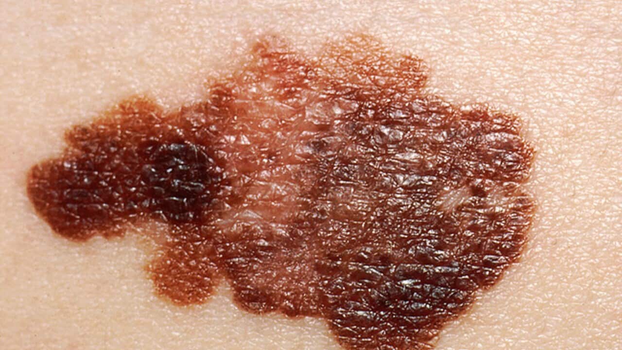 Image for read more article ''