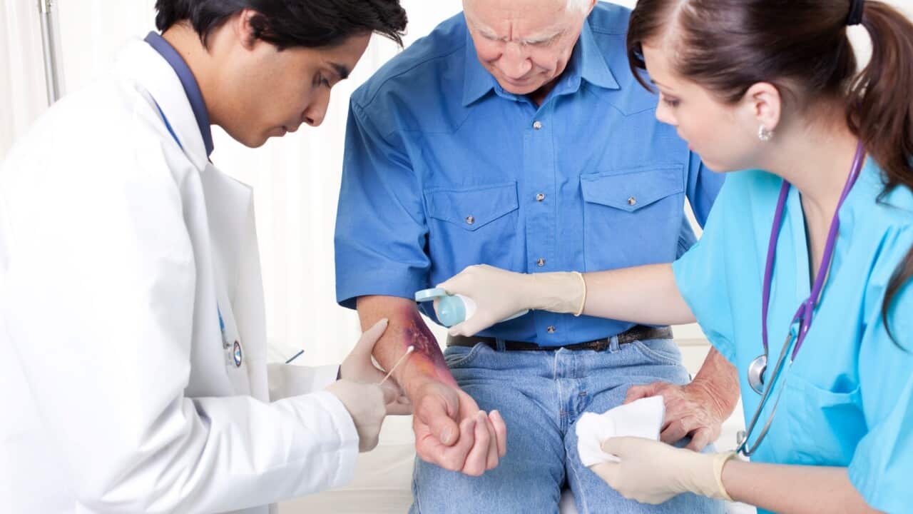 Things You Should Never Do to a Burn