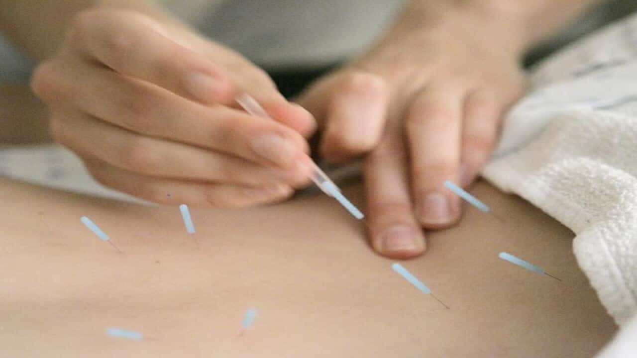 acupuncture needles in the muscles around the spine