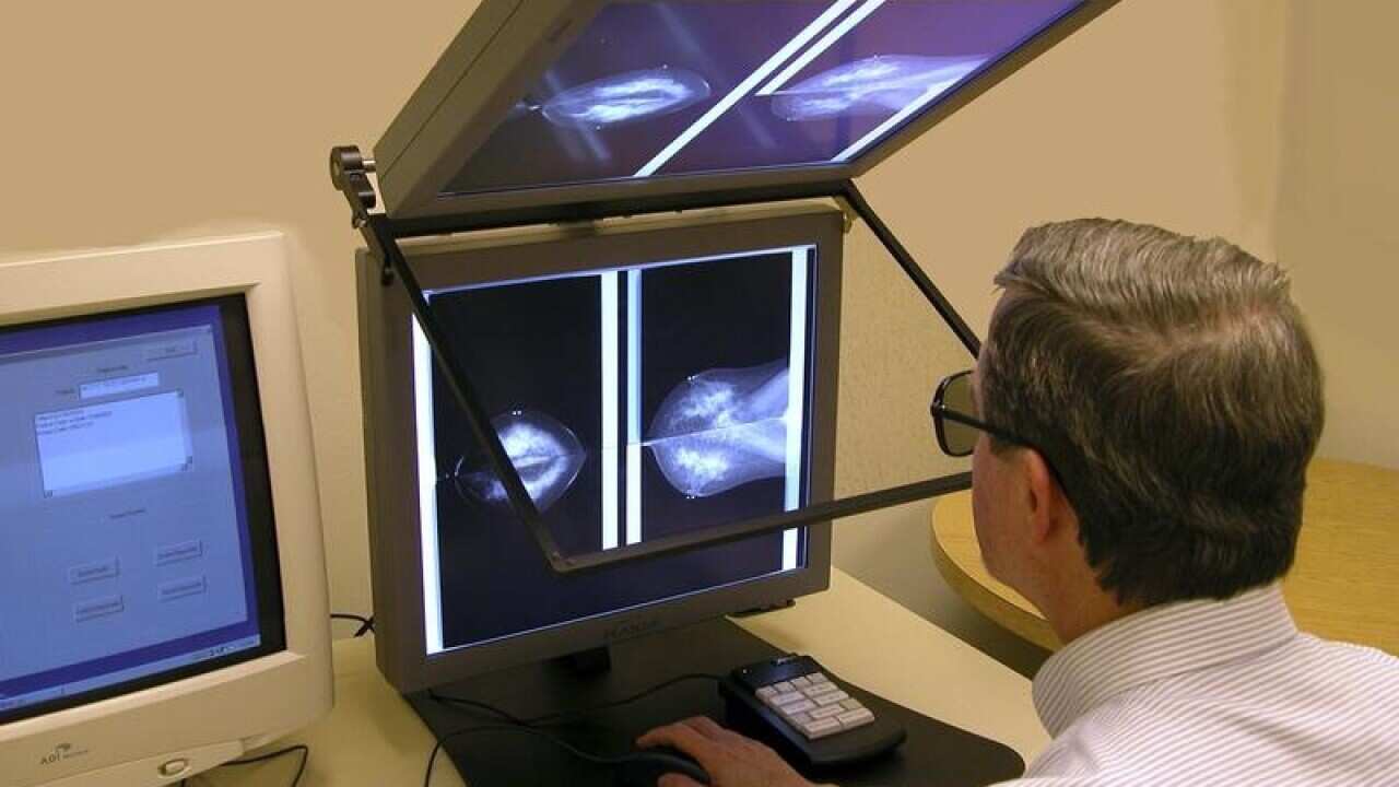 Scientist at BBN Technologies to review breast images