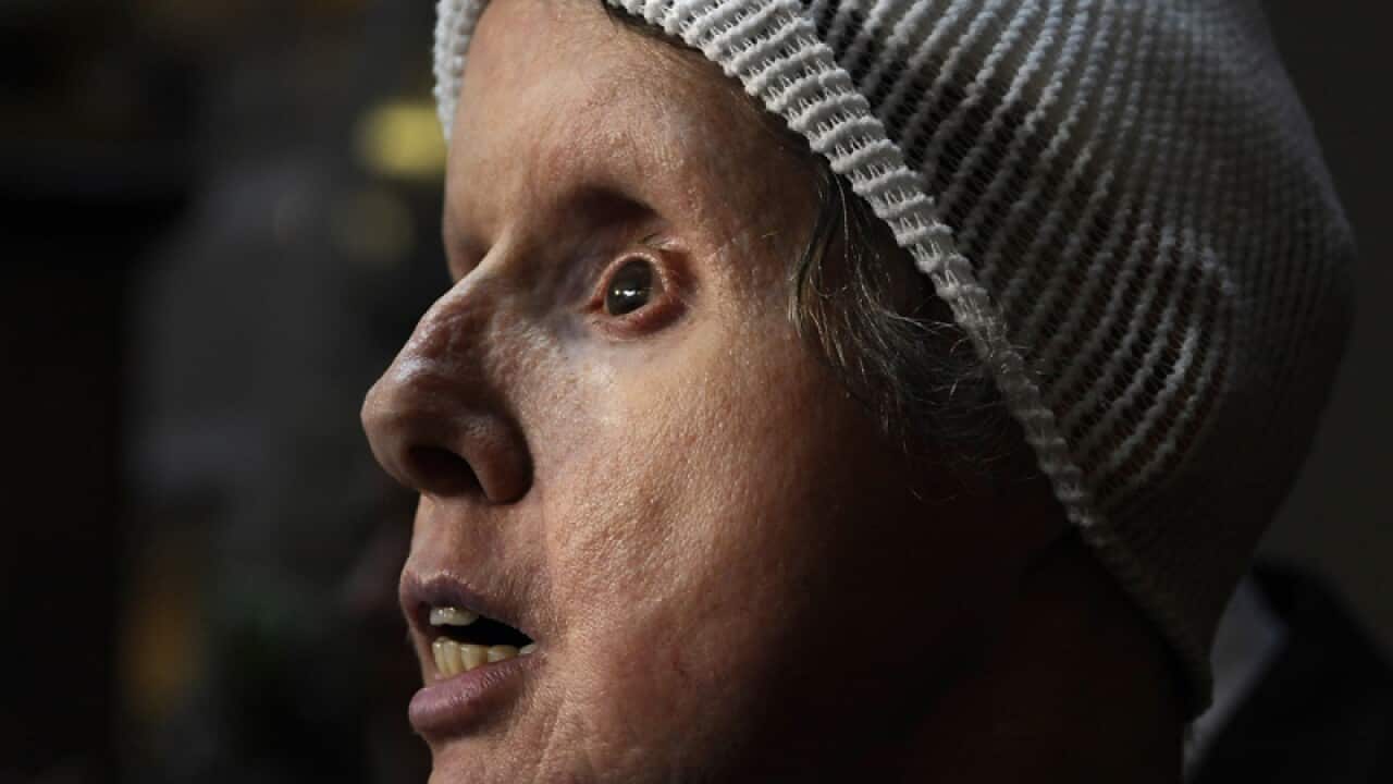 Charla Nash before attending a public hearing with Connecticut