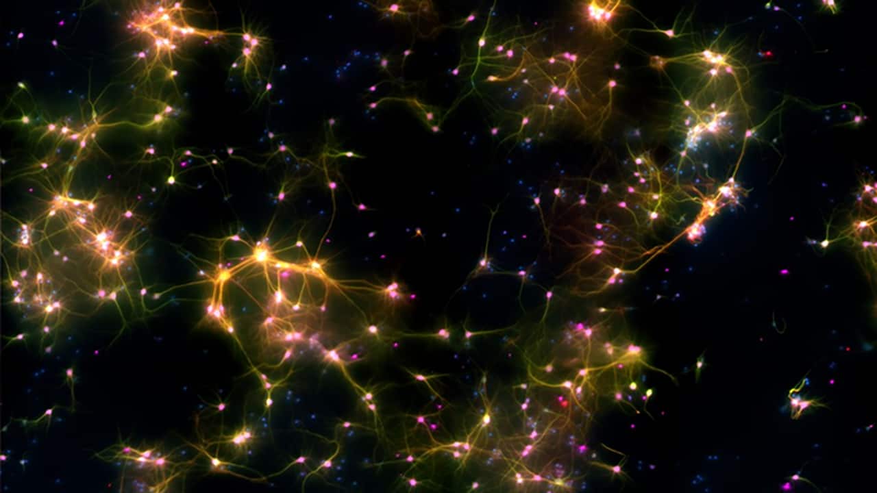 Human brain cells in a dish can play Pong