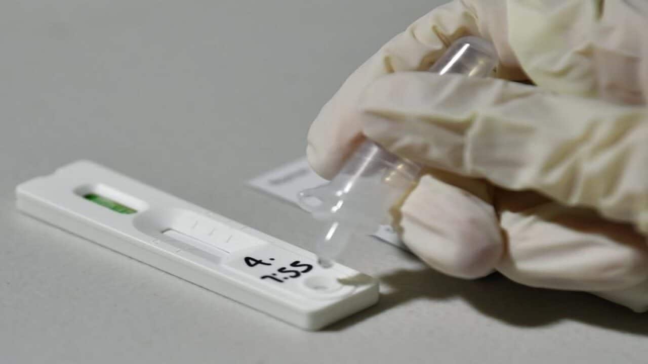A COVID 19 rapid antigen test.