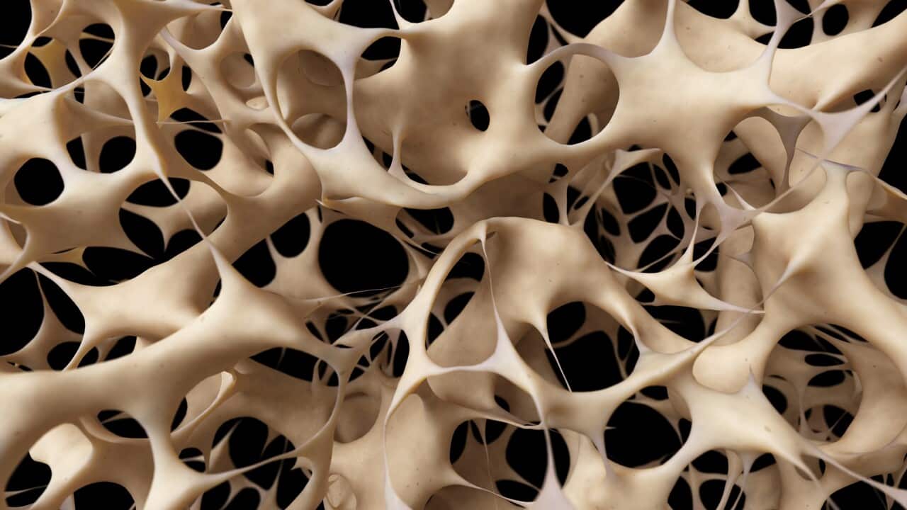 Bones with osteoporosis, illustration