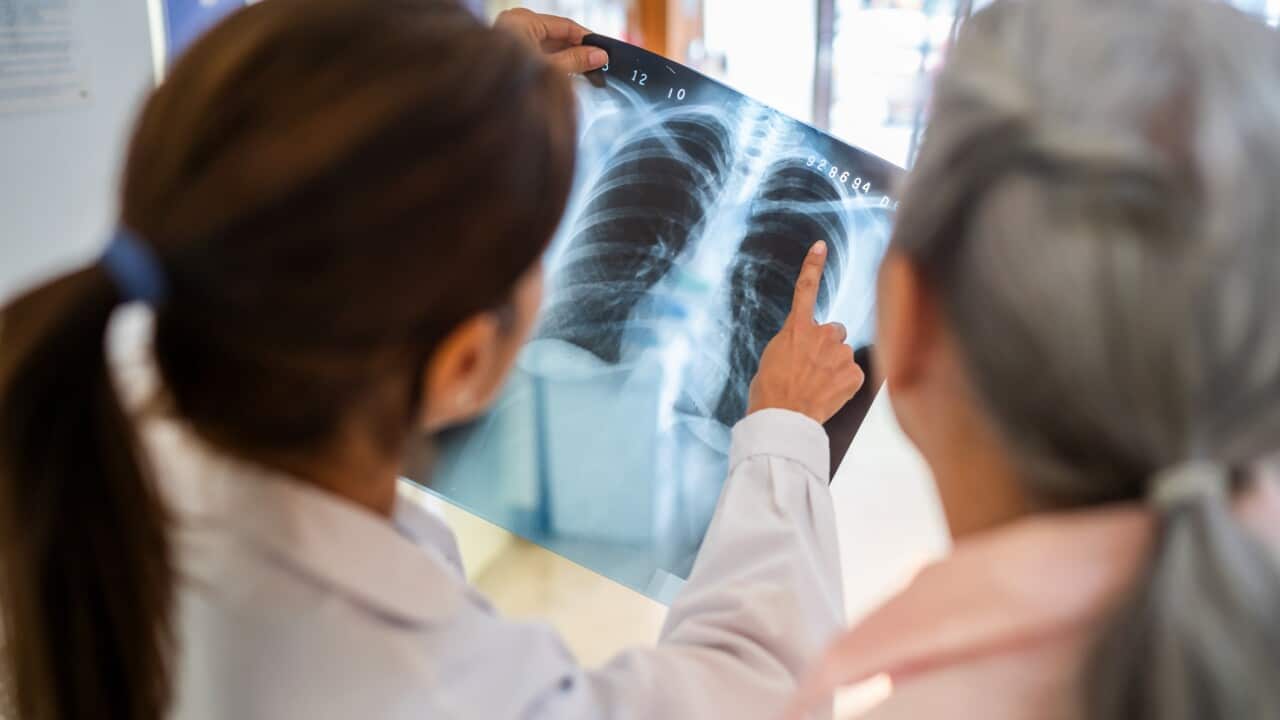 Doctors Analyzing a Chest X-Ray in Hospital