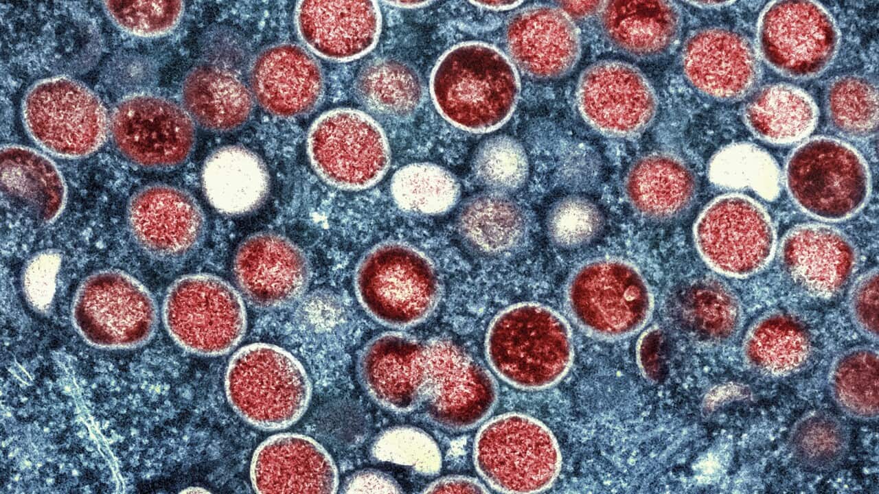 A microscopic image of cells