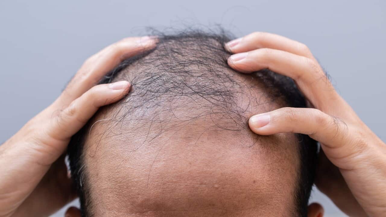 Cropped shot view of baldness Asian man