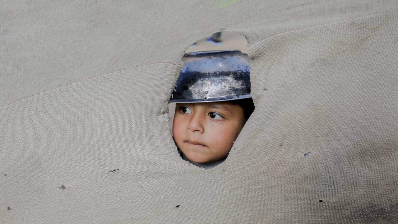 Israel Is Causing Starvation UN Report - Gaza