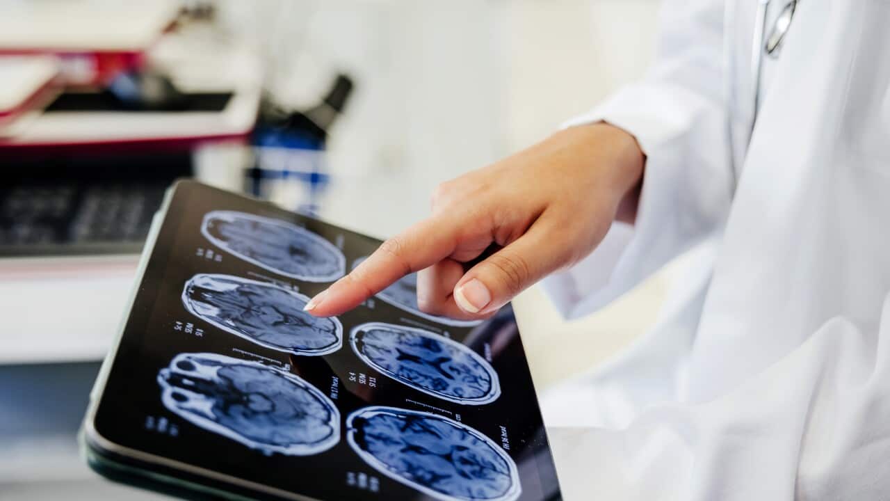 Close-up Shot of a Doctor's Hand Pointing on Brain Scan Images on Digital Tablet