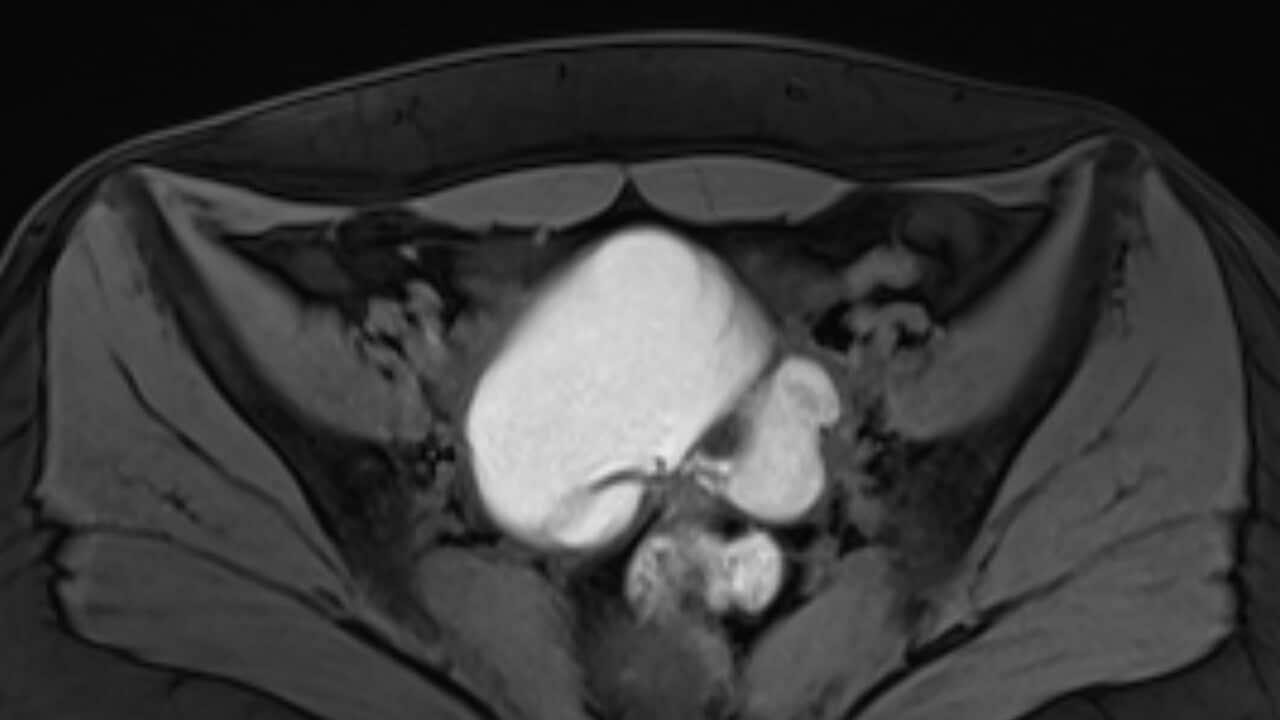 Image for read more article 'READ MORE'