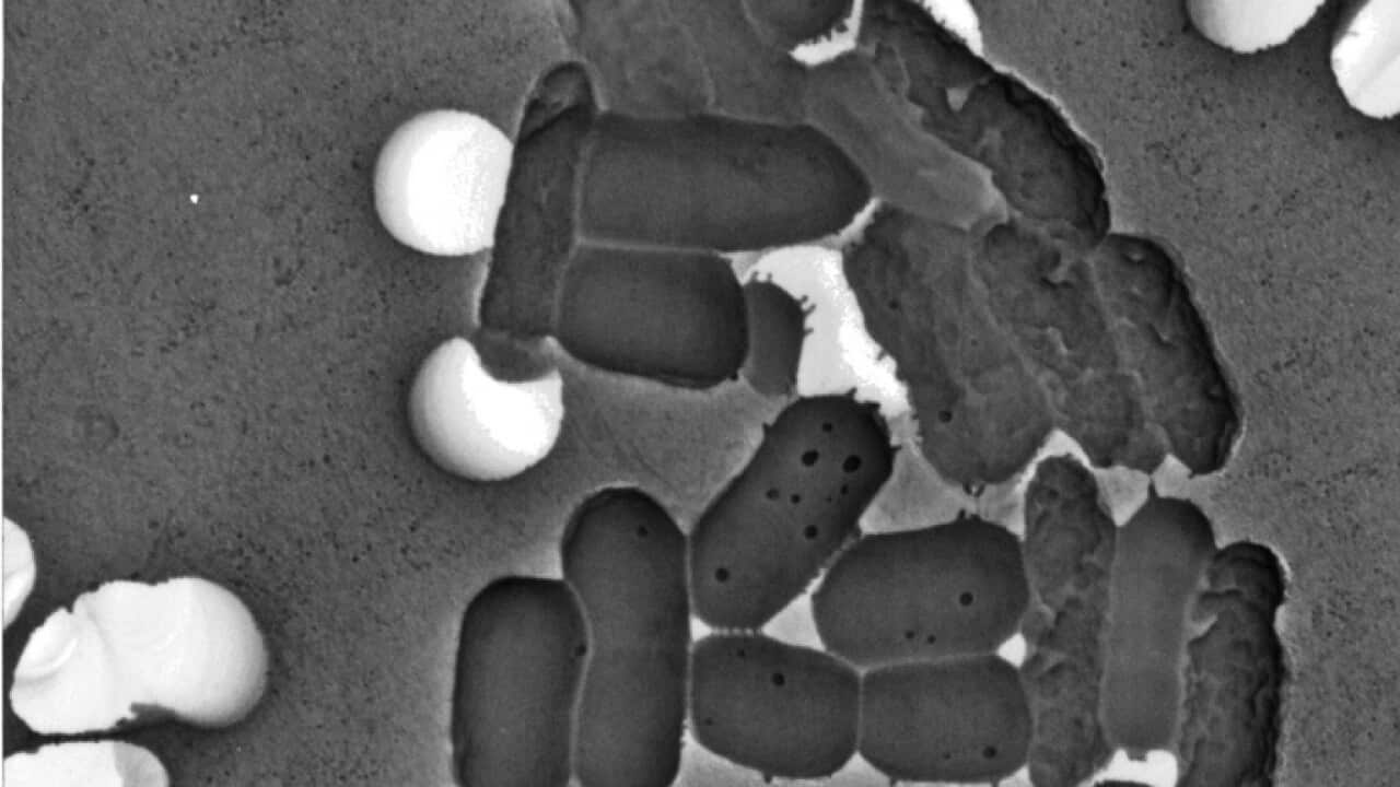 تصویر میکروسکوپی از باکتری ها