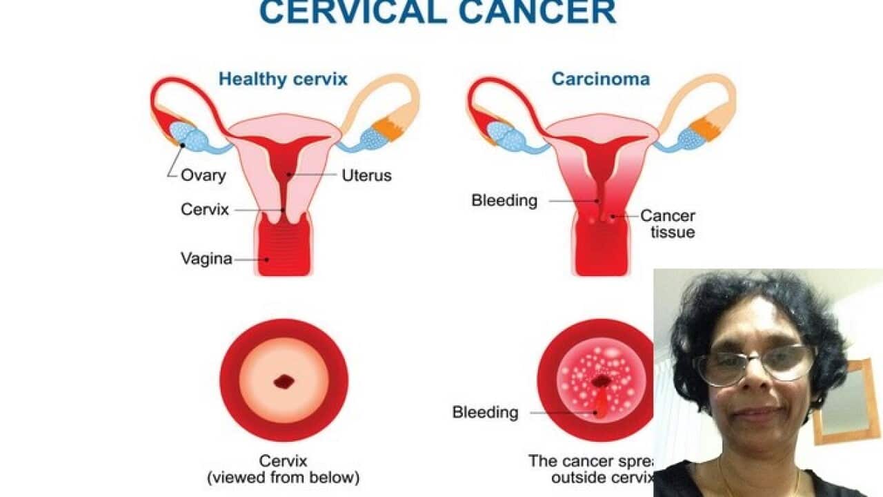 HPV test