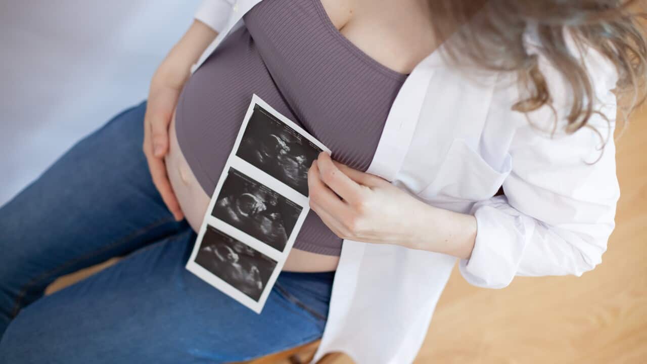 a pregnant woman holds an ultrasound with a photo of the baby in her hands