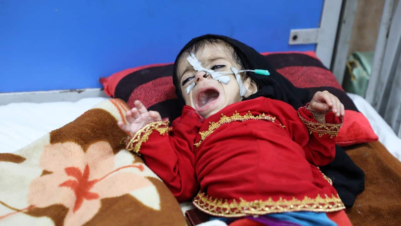 Children suffering from malnutrition in Afghanistan