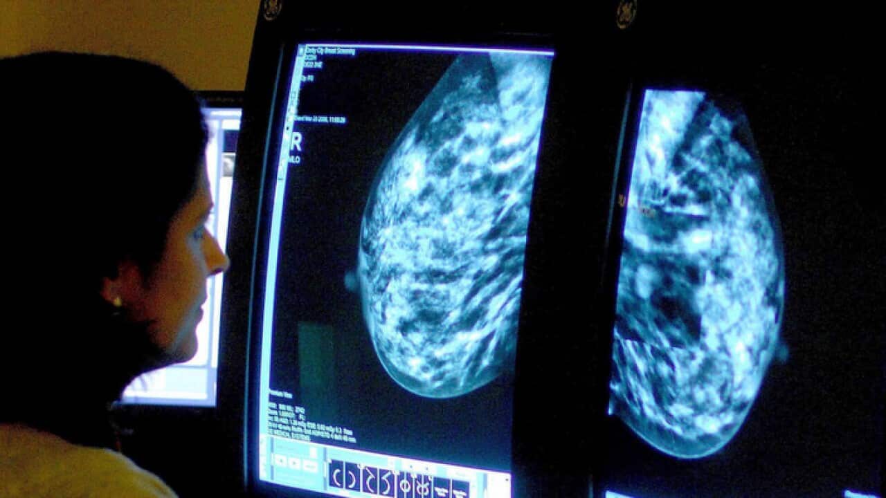 Doctor checks a mammogram