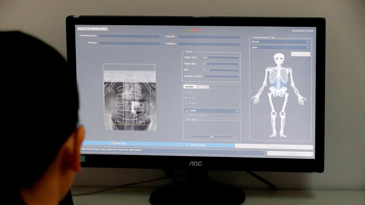 Medix 90 a tool for routine osteoporosis and fracture risk assessment. Cardiology hospital. Ho Chi Minh City. Vietnam.