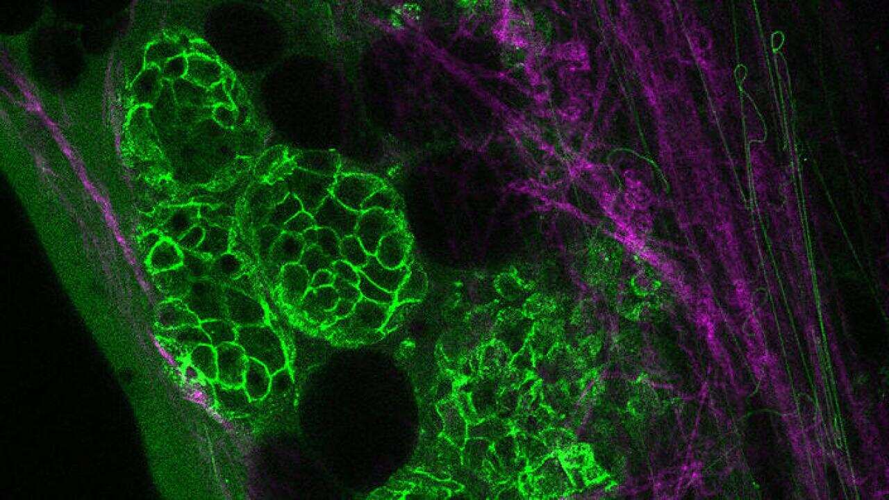 Cancer Cells