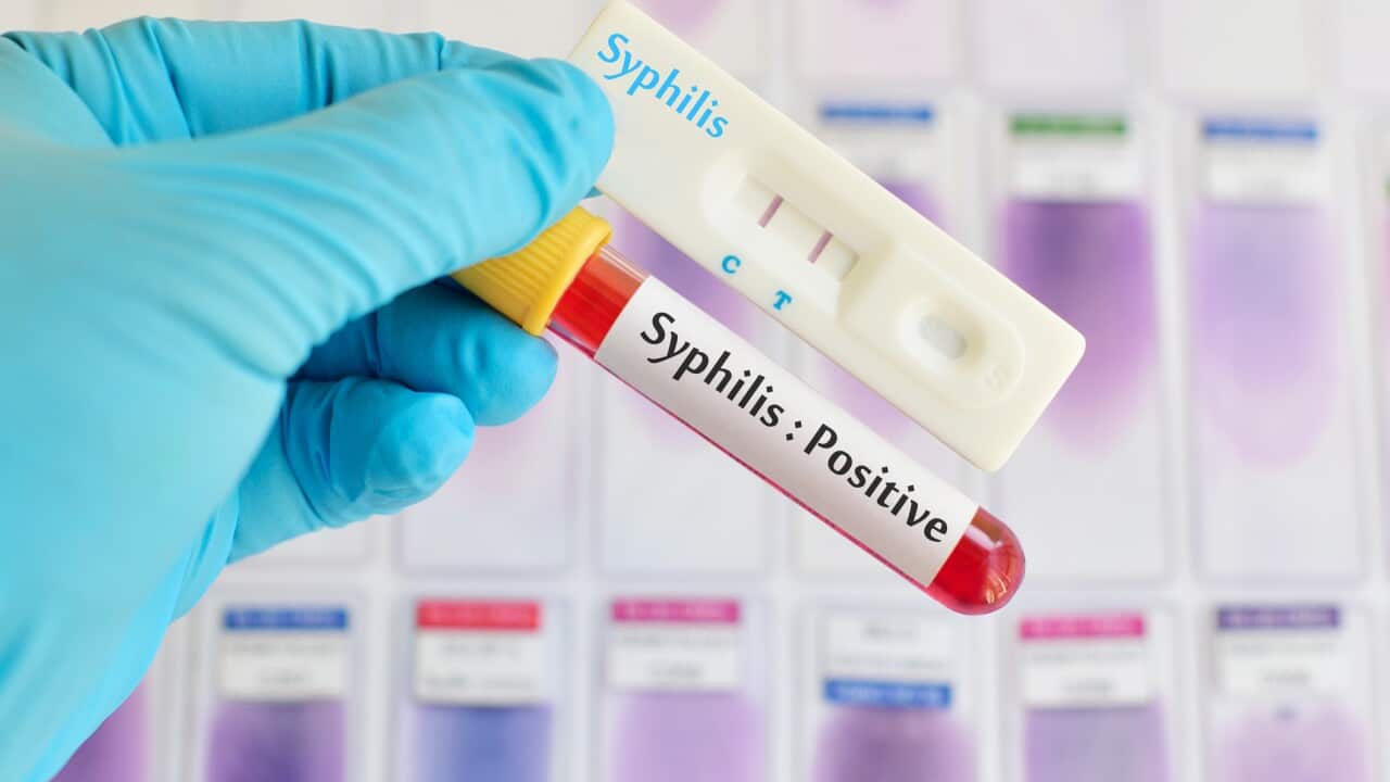 Syphilis testing positive