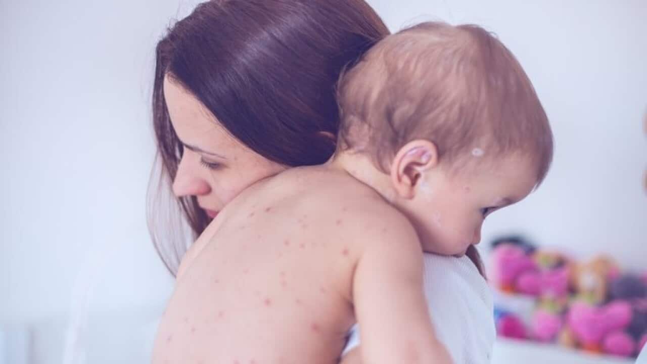 People are immune after two doses of measles-containing vaccine or if they had measles as a child.