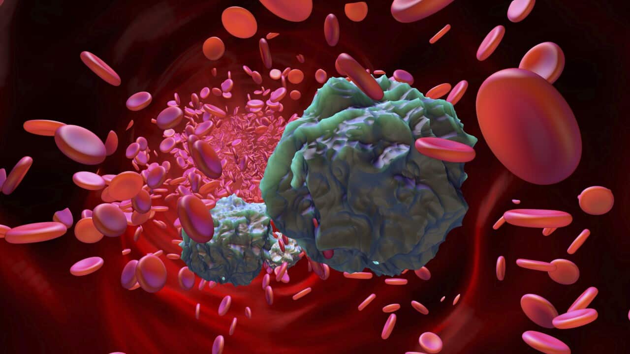 Image for read more article ''