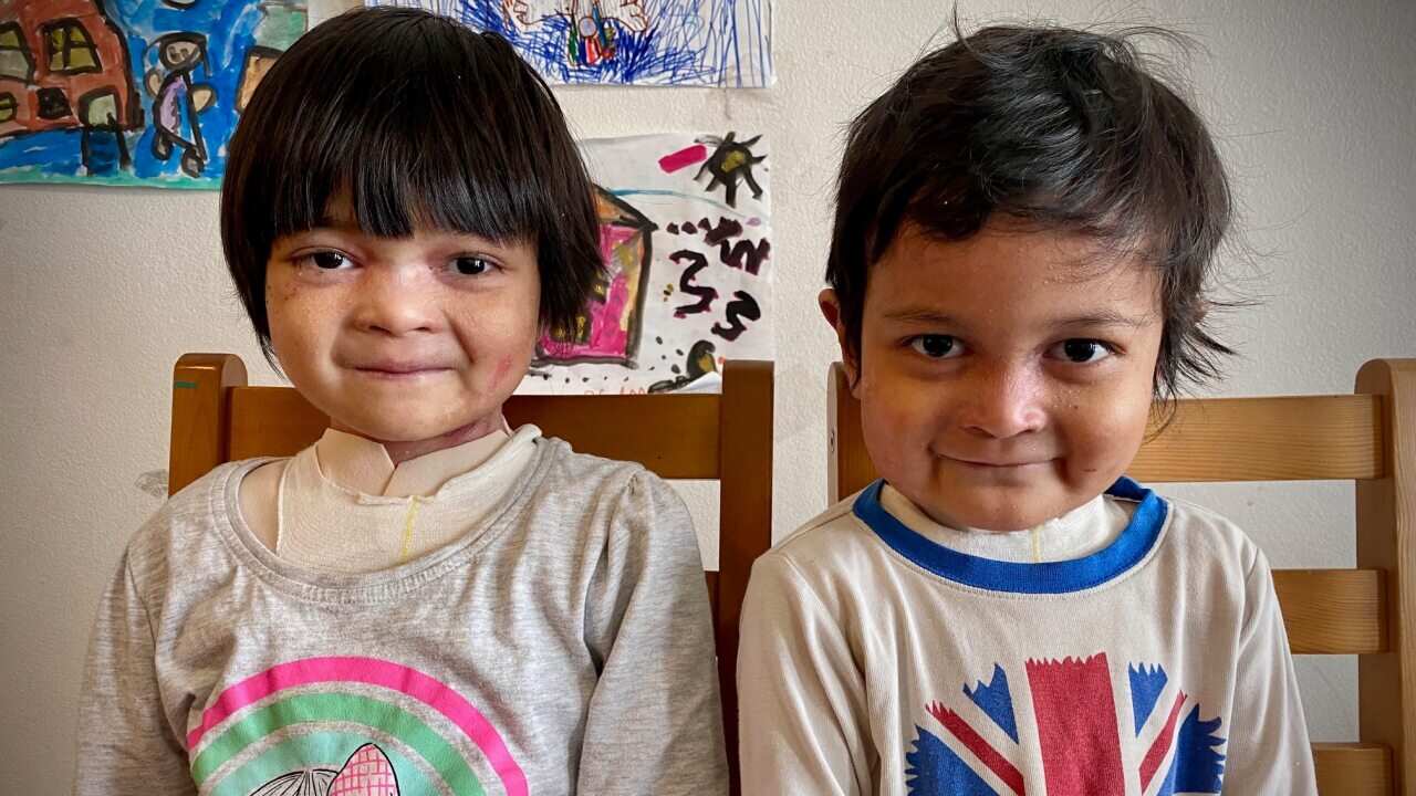Nur Siddiqah, 8, and Muhammad Azraqee, 5, were born with Recessive Dystrophic Epidermolysis Bullosa.
