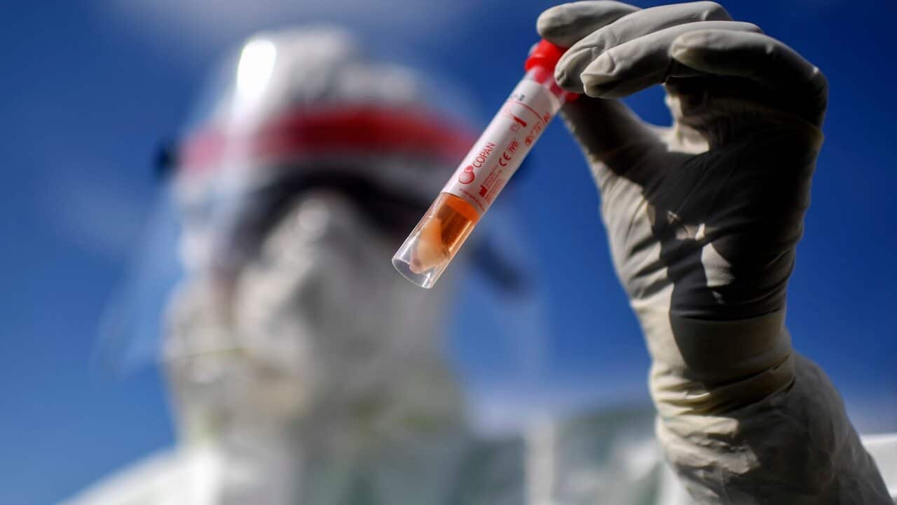 Doctor of the Giugliano Hospital show the test tube for people who have to carry out the test for the coronavirus COVID-19.