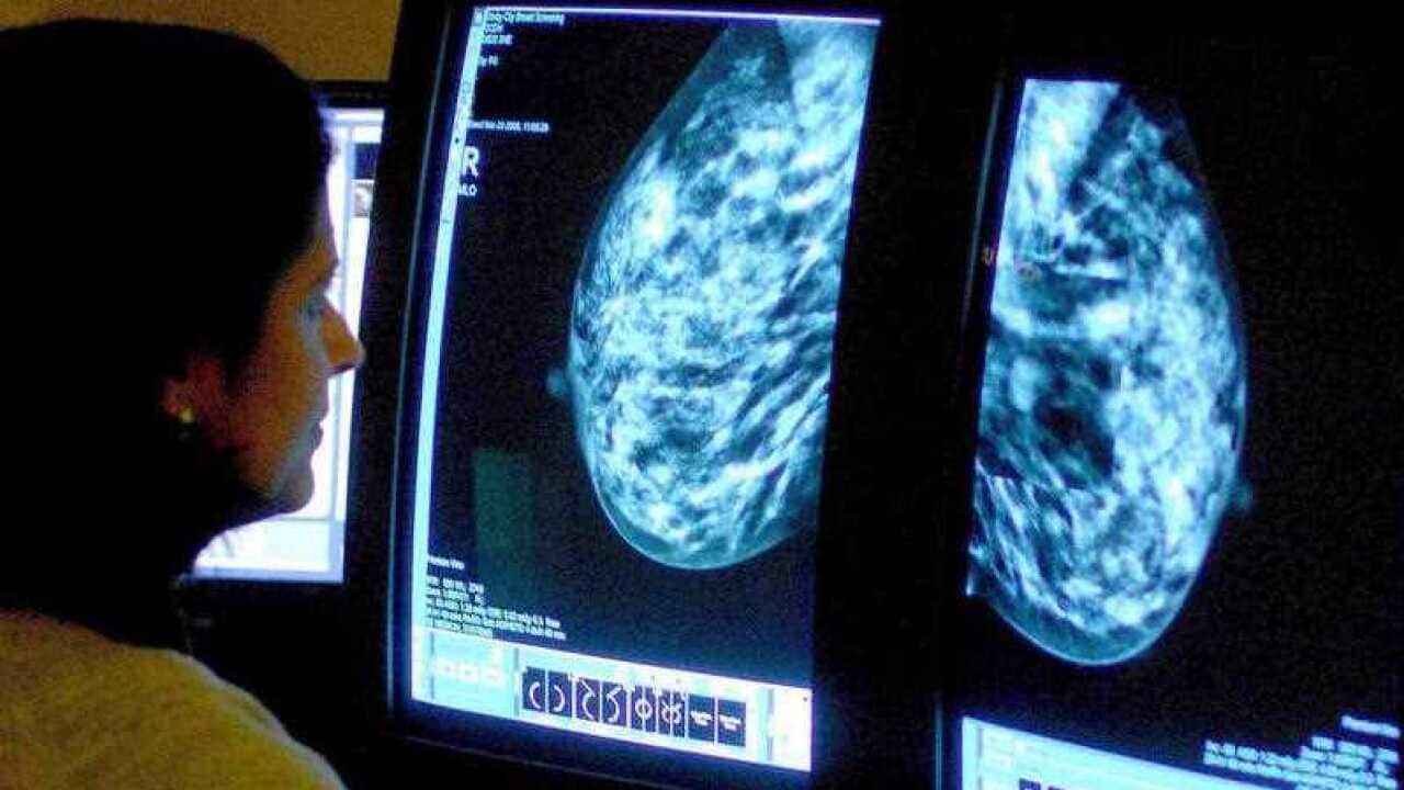 breast cancer mammogram