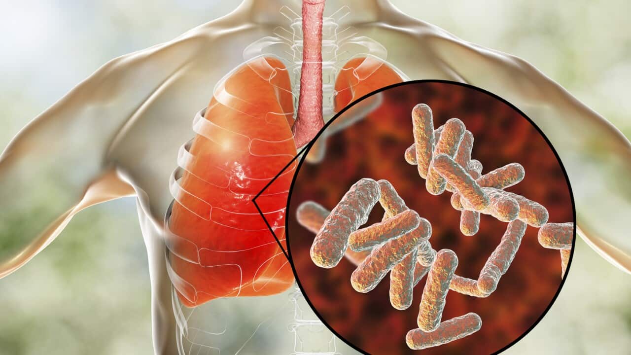 Bacterial pneumonia, conceptual illustration