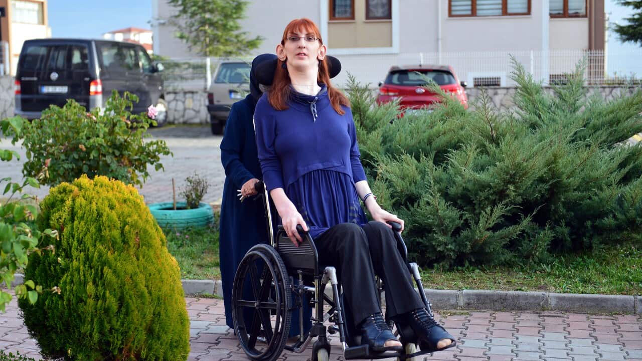 The world's tallest living woman 24-year-old Rumeysa Gelgi in Karabuk, Turkey