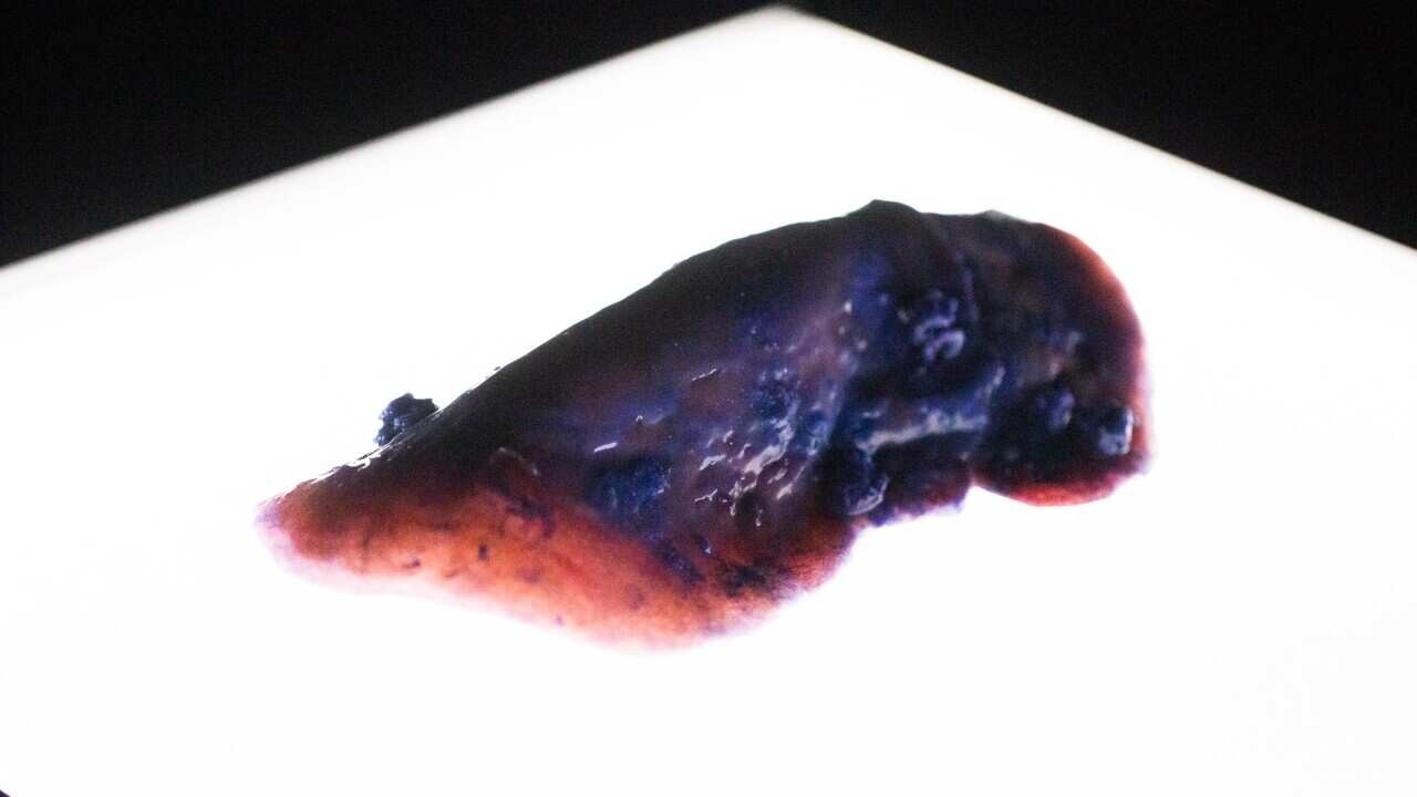 Noemie-Soula_Mythical-Living-Data_Liver-Microplastics_Photo-Andy-Brown.jpg