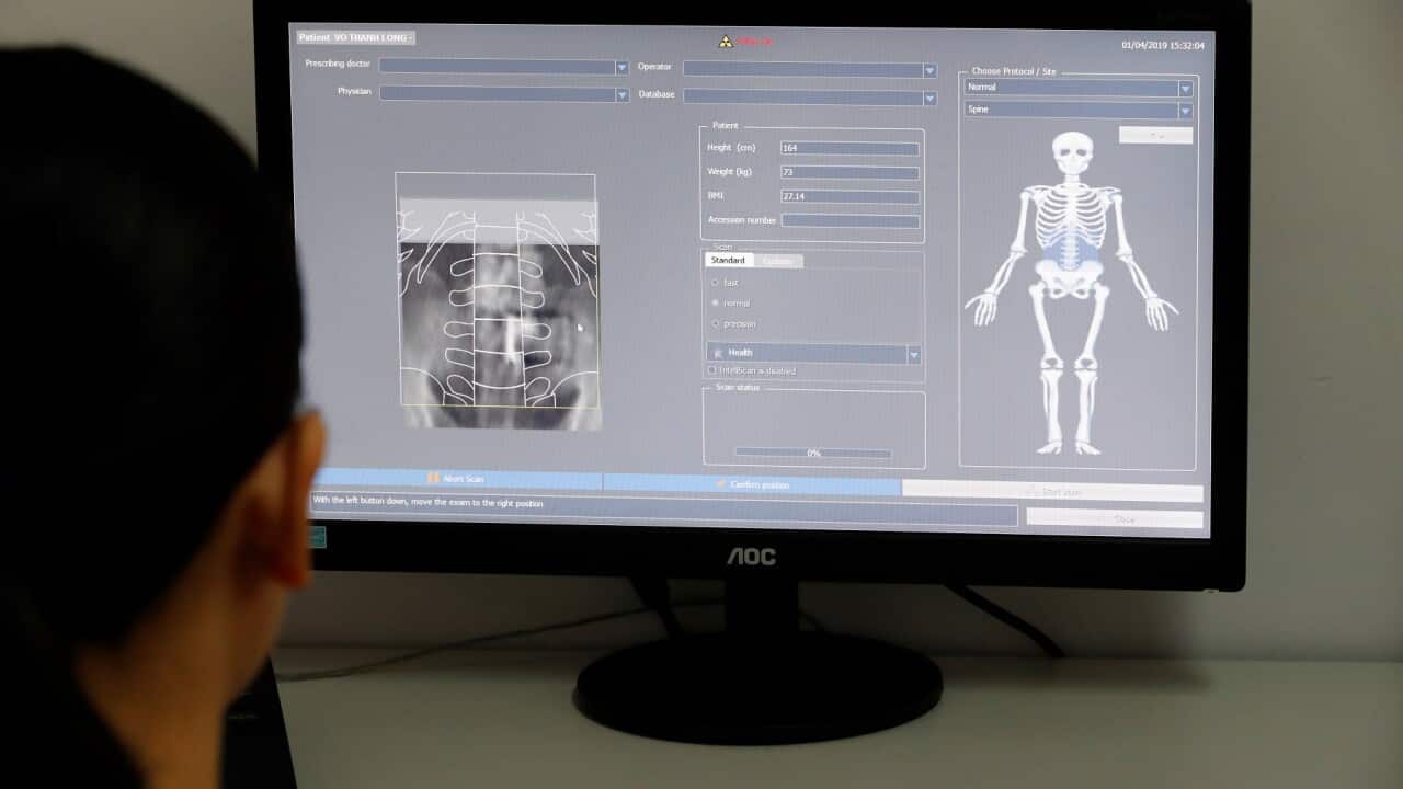 Medix 90 a tool for routine osteoporosis and fracture risk assessment. Cardiology hospital. Ho Chi Minh City. Vietnam.