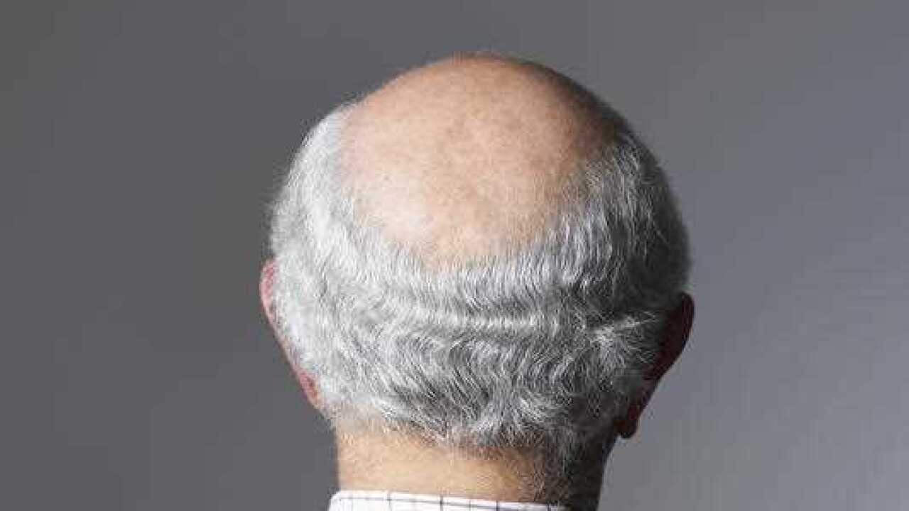 Scientists have found he gene behind greying hair and baldness.