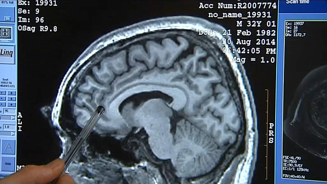 A doctor examines a patient's brain scan