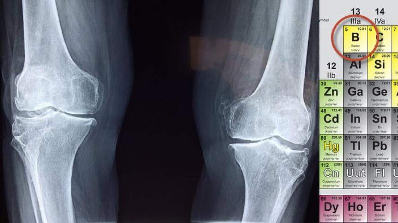 Boron has an important role in the treatment of osteoporosis