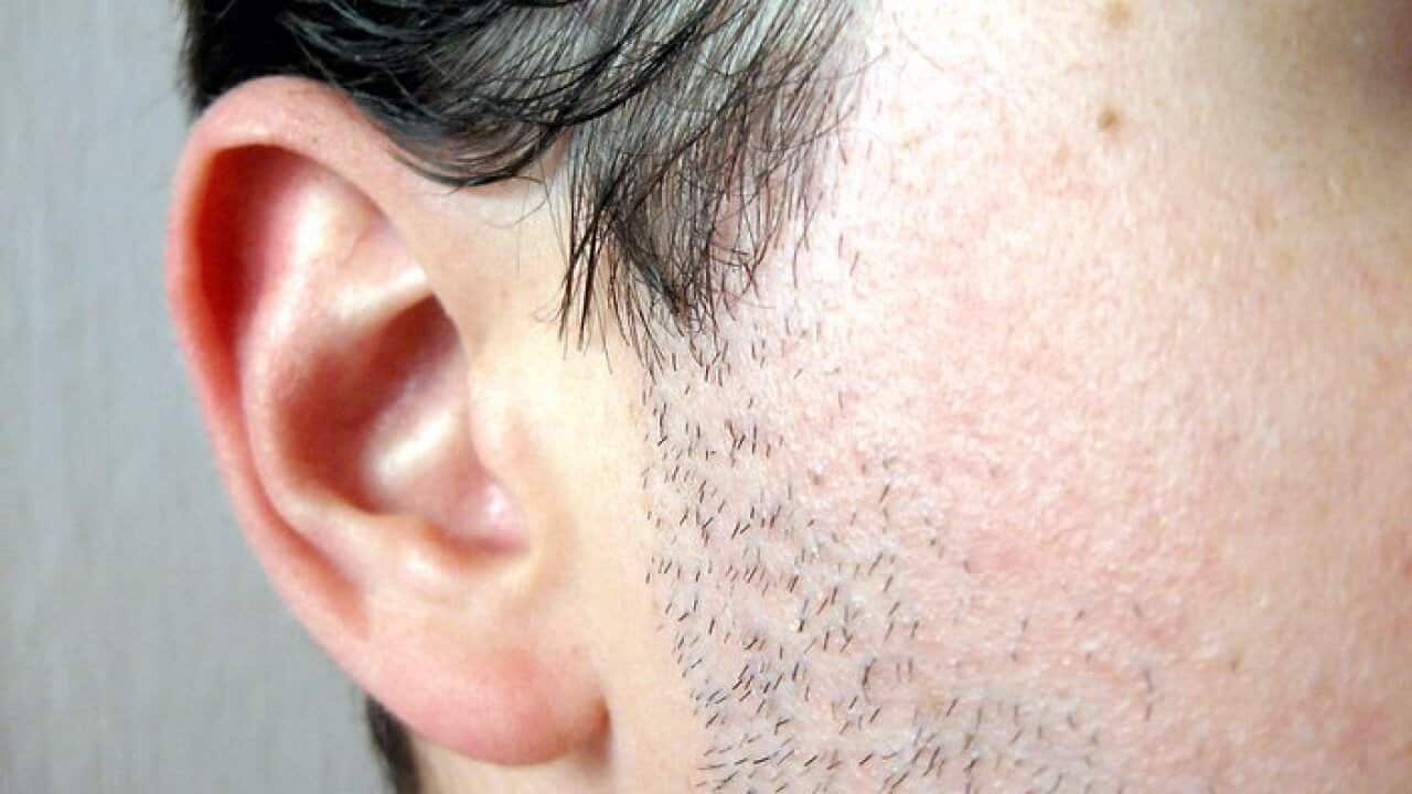 Causes of ear infections SBS Maltese