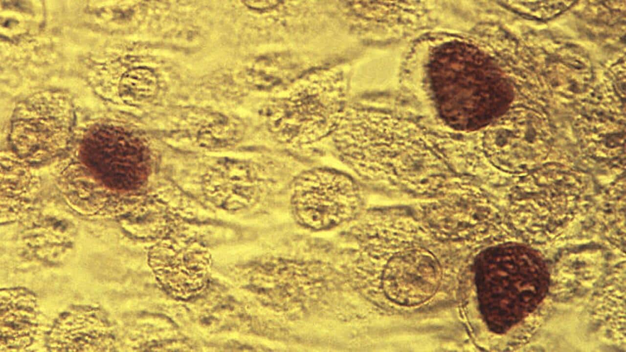 Chlamydia is rising but HIV rates remain stable, says a new report card on Australian sexual health. (AAP)