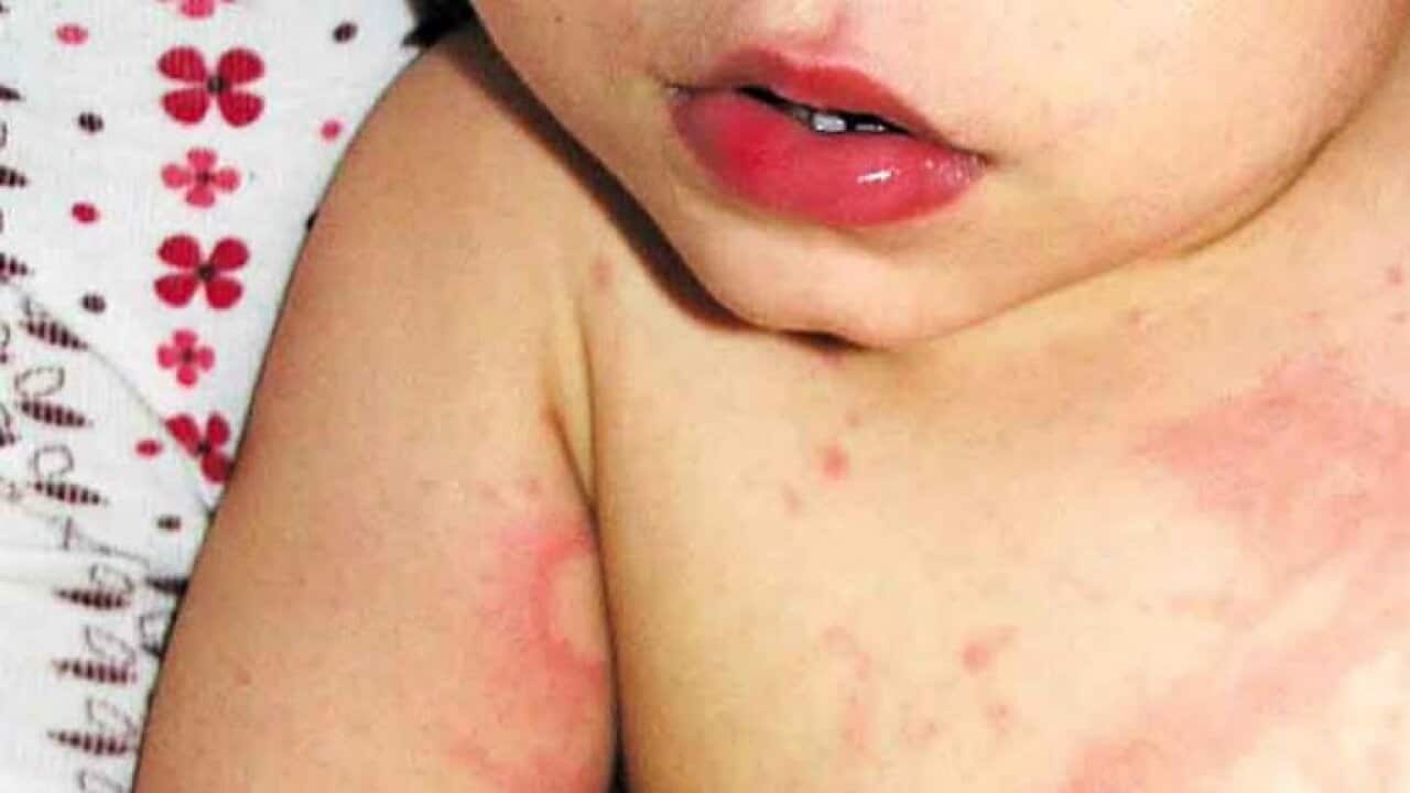 Image for read more article 'READ MORE'