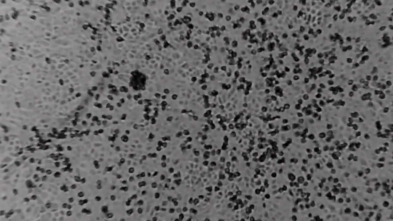 Video image showing the novel coronavirus at Melbourne's Peter Doherty Institute for Infection and Immunity