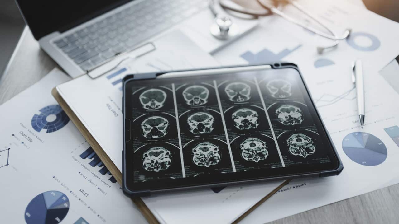 Close-up of a digital tablet with brain x-ray on screen.