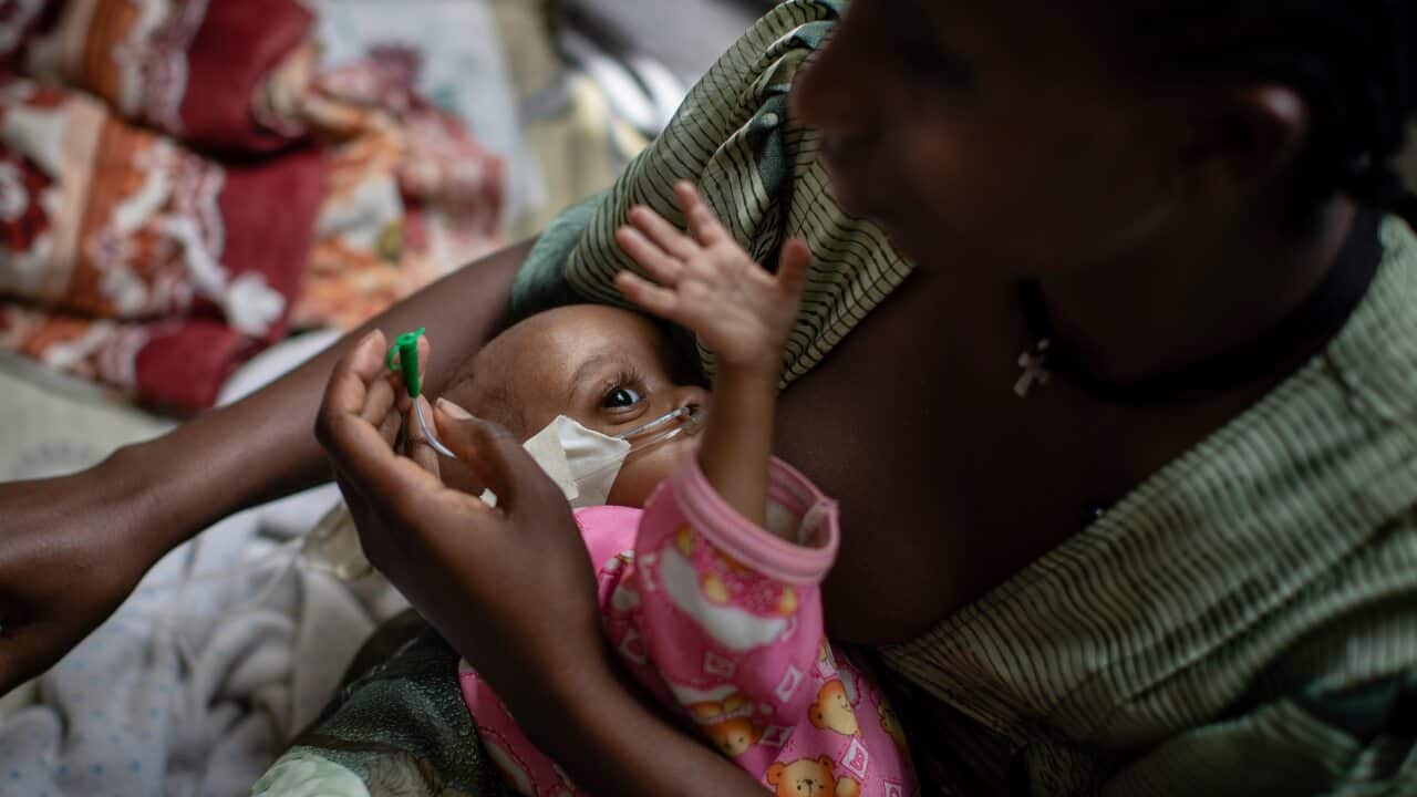A malnourished baby at the Ayder Referral Hospital in Mekele, Tigray, on May 10, 2021.