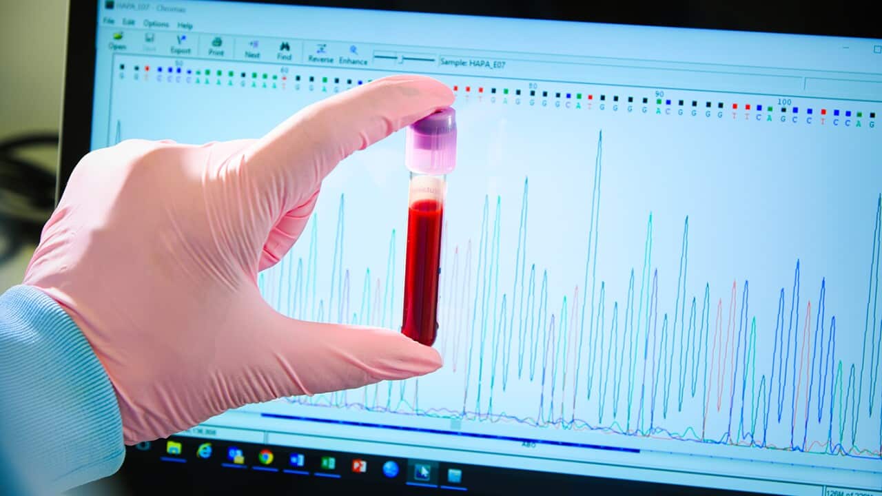 Australia's most common blood types are changing and new research suggests it's linked to the country's multicultural diversity.