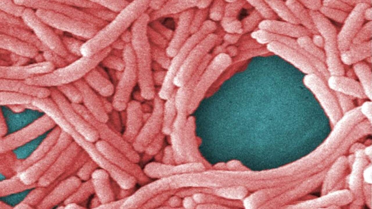 a large grouping of Legionella pneumophila bacteria