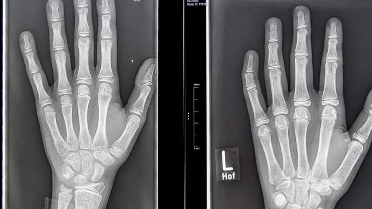 hand x-rays
