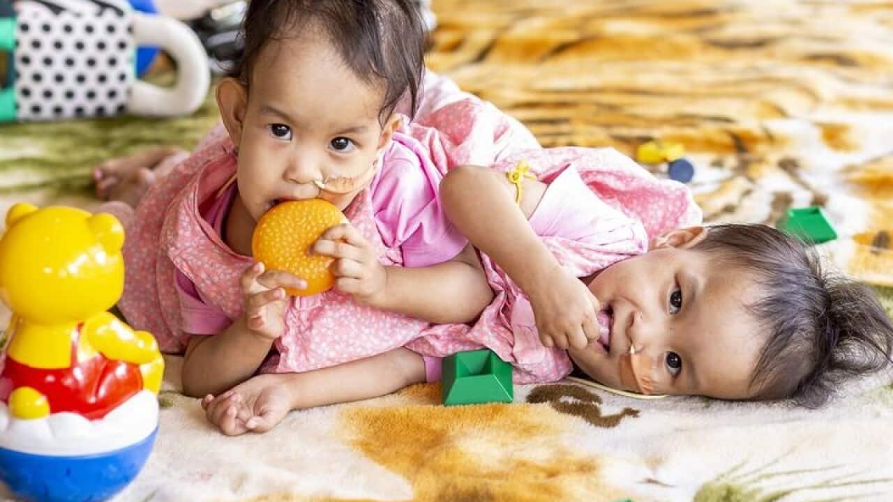 Formerly conjoined twins Nima and Dawa