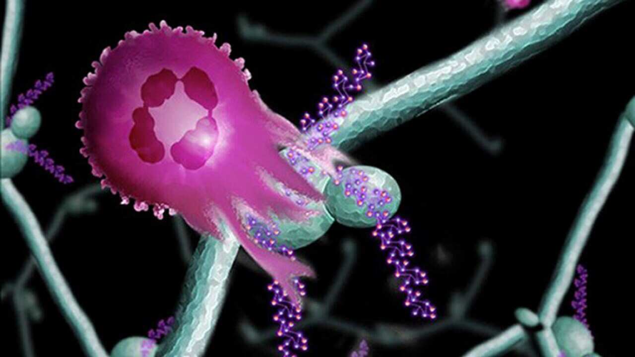 Undated handout artist impression issued by LIfT BioSciences of a neutrophil attacking a cancer cell